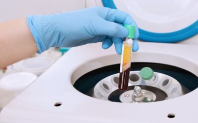 Tratamientos Regenerativos para el Pie: ¿Cómo el PRP Puede Ayudar a tu Recuperación?
